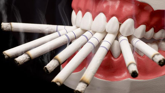 Влияние курения на зубы
